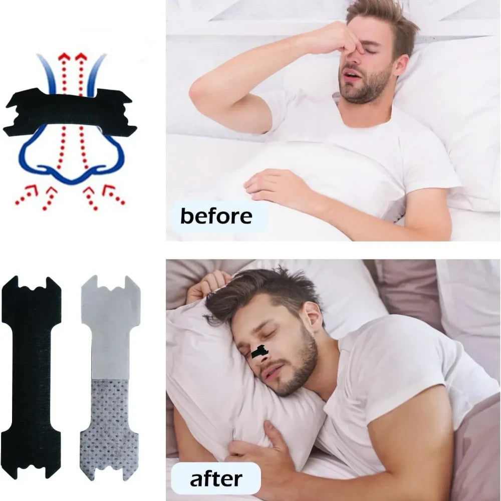 Sports Nasal Strips